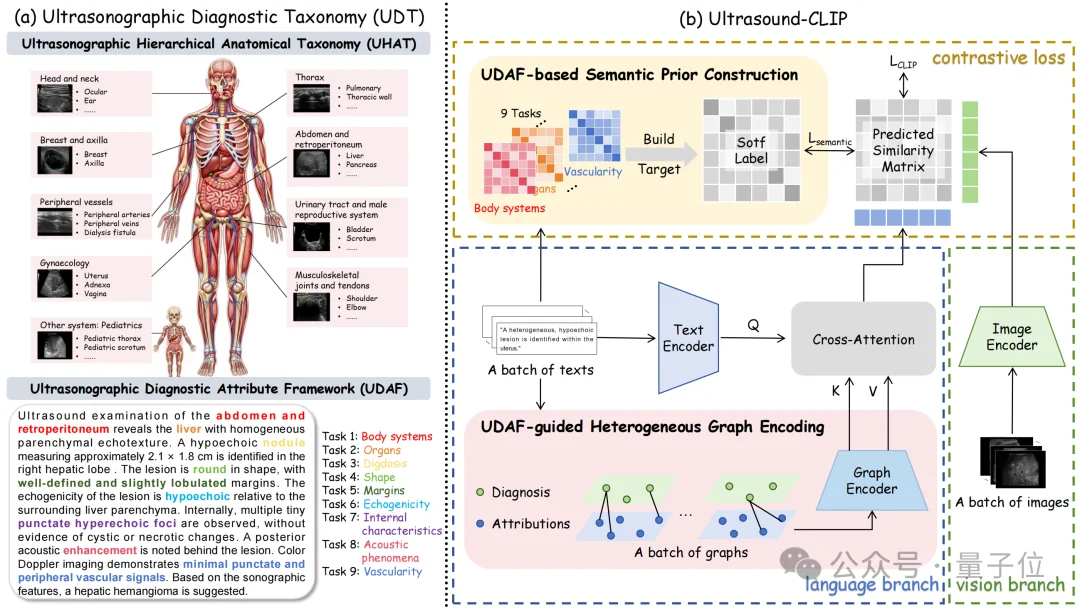 36.4万超声图文对!中国团队构建首个大规模超声专属数据集,让AI真正读懂临床诊断语义丨CVPR'26